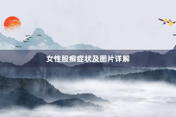 女性股癣症状及图片详解